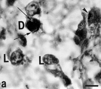 Tmavé (D) a světlé (L) pinealocyty v epifýze. Měřítko 1.5 µm